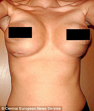 Opinion My bad boob job My bad boob job excited